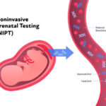 Non-Invasive Prenatal Testing